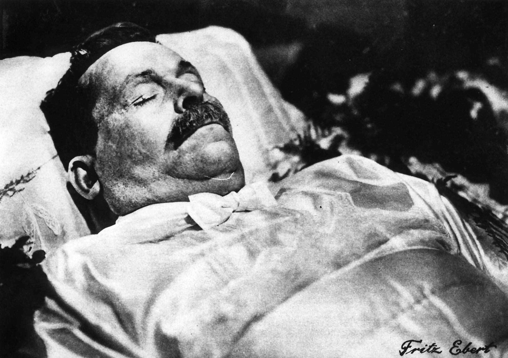 Friedrich Ebert auf dem Totenbett, 1.3.1925
