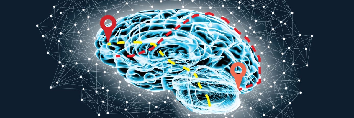 Illustration eines menschlichen Gehirns auf schwarzem Hintergrund, umgeben von einem Netzwerk von Punkten.